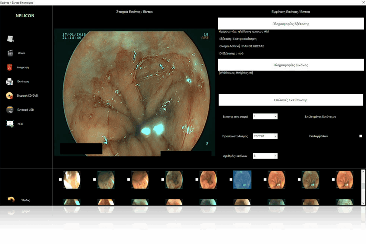 NELI features Capturing and Database Documentation option in order to record image and video, as well as managing your patient data creating reports.