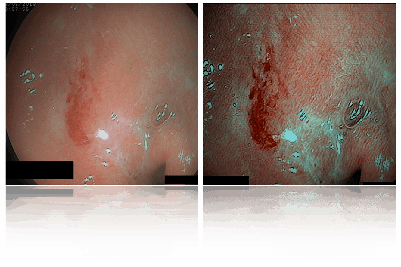 Real time applied filters for enchancment improvement